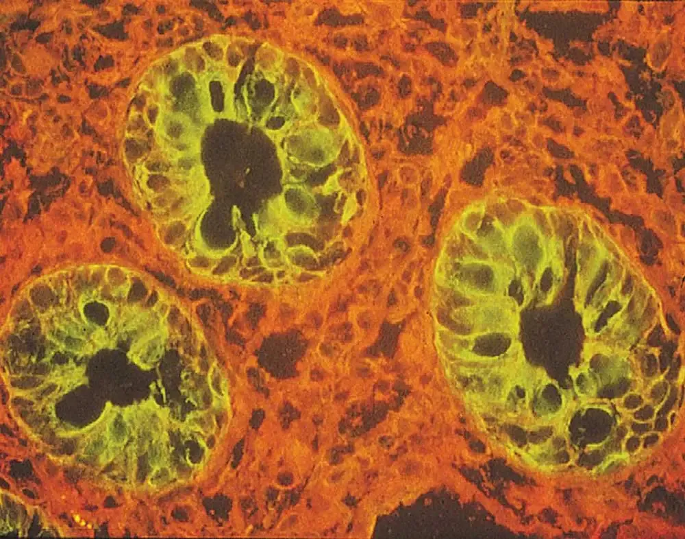 Lectins Image1 1000x786